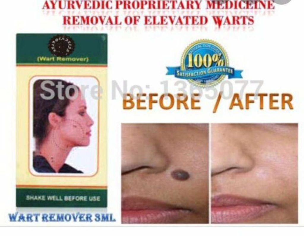 wartosin-wart-remover-medstore